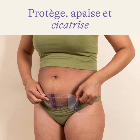 Patch hydrogel césarienne - Cicatrisation post-accouchement - 5